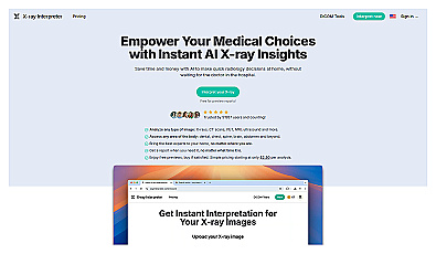 X-ray Interpreter